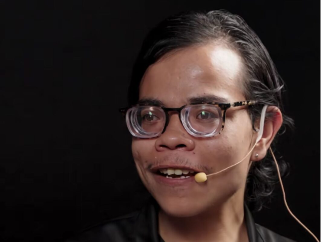 Luis Armando, conocido como El Chico Pony, sonriendo durante una entrevista usando lentes de aumento gruesos y micrófono de diadema.